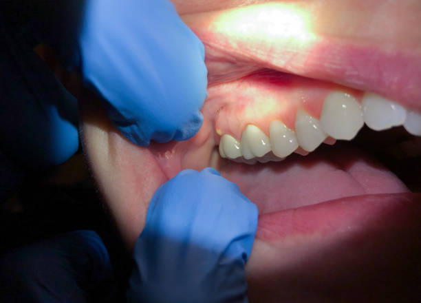 Professional Emergency Dentist in SC
